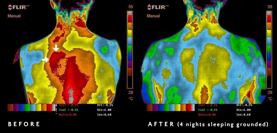 Inflammation & Earthing